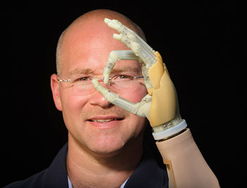 Touch Bionics I-Limb hand. Click to learn more